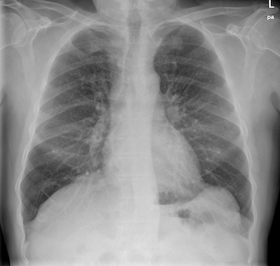 Weekend Editor's heart and lungs